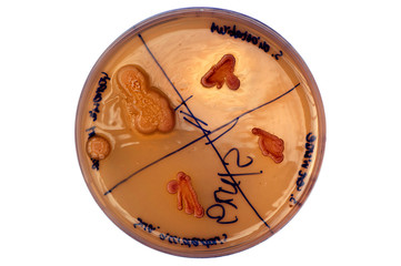 isolated petri plate