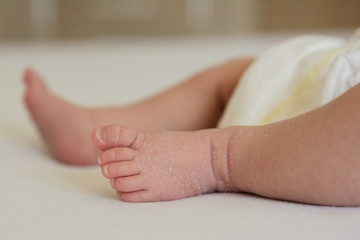 Fototapeta baby newborn feet dry skin  obraz