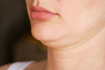 face line correction. a woman with a second chin - obrazy, fototapety, plakaty