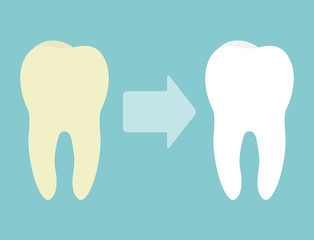 Teeth whitening concept