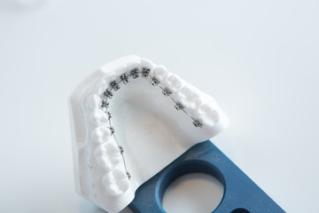 Dental lower jaw bracket braces model on white