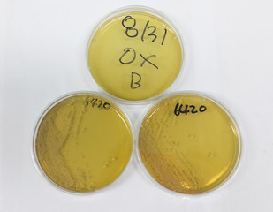 Microbiological analysis