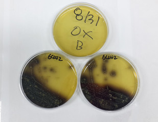 Microbiological analysis