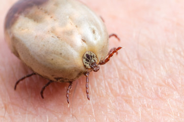 Tick filled with blood sitting on human skin