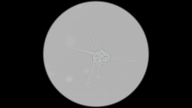 the movement of an amoeba-a parasite under a microscope