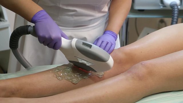Laser epilation and cosmetology.