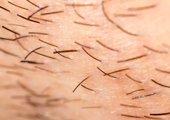 Bristles on the beard of a man