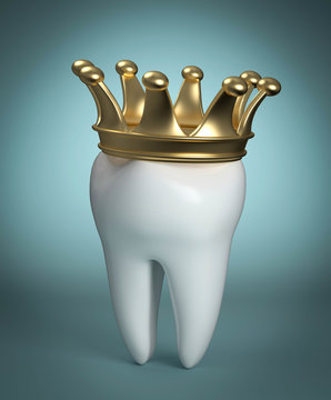 3d Zahn mit Krone