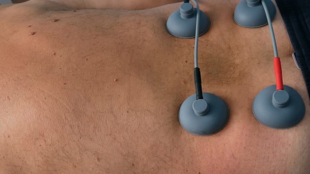4K UHD panning footage of  electro stimulation medical procedure with caucasian male senior patient and nurse preparing him for it