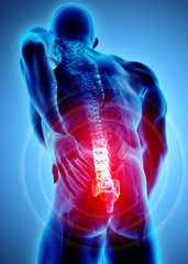 3D Illustration of sacral spine painful.