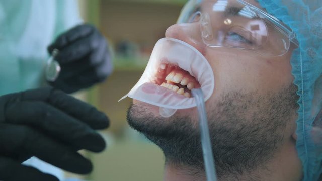 Doctor and patient with lip dilator in the dental office, close up of cleaning and rinsing of the teeth, final processing