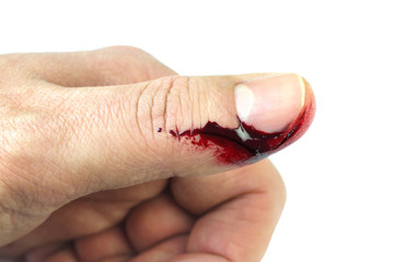 Finger on left thumb human hand is cut hurt and bleeding 