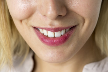 Closeup of smiling woman's teeth