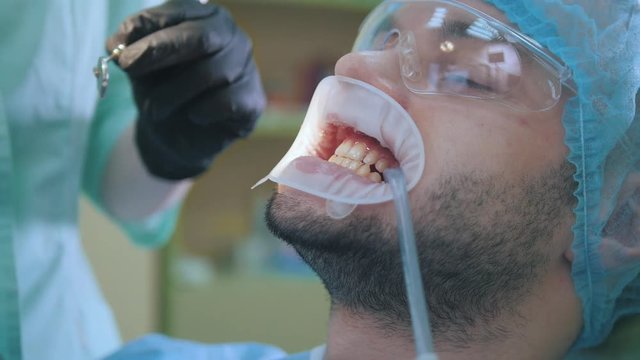 Doctor and patient with lip dilator in the dental office, close up of cleaning and rinsing of the teeth