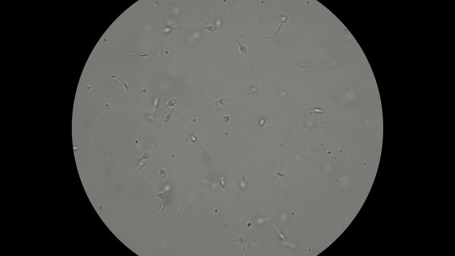 the movement of the sperm under a microscope