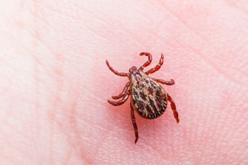 Encephalitis or Lyme Virus Infected Tick Arachnid Insect on Skin