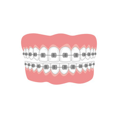  Teeth with braces on white background.