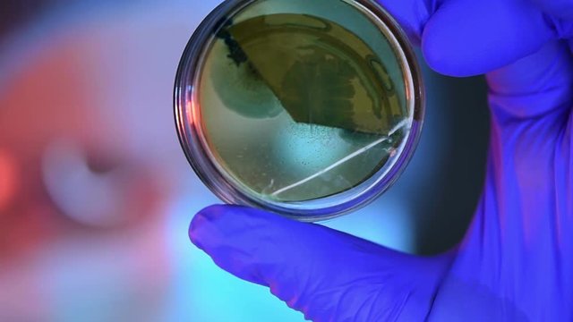 Scientist examining bacterium colonies in petri dish, rack focus