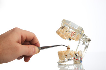 Fototapeta na wymiar Dentist hands pulls out a tooth with dental forceps from jaw model over white background, close-up. Student learning teaching model showing teeth, roots, gums, gum disease, tooth decay and plaque.