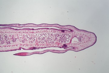 Segment of a tapeworm body (Proglottid)