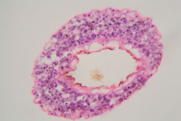 Schistosoma mansoni parasites under the microscope.