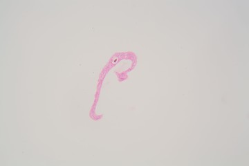 Schistosoma mansoni parasites under the microscope.