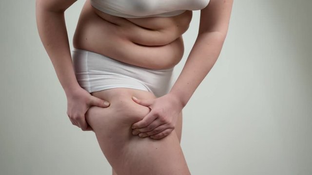 Woman in white underwear holds her fat hips.