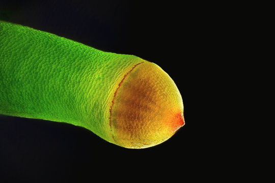 Spore capsule of a moss, microscope image