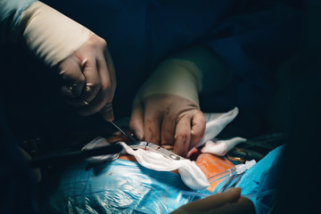 Needle holder or a needle driver in doctor's hand, a surgical instrument or a hemostat, used by...