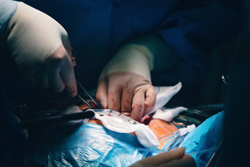 Needle holder or a needle driver in doctor's hand, a surgical instrument or a hemostat, used by...