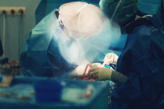 surgeons in hospital operating room with surgery instruments ready for cardiovascular surgery interventions with electrocautery in surgeon hand and all technology equipment for open heart microsurgery