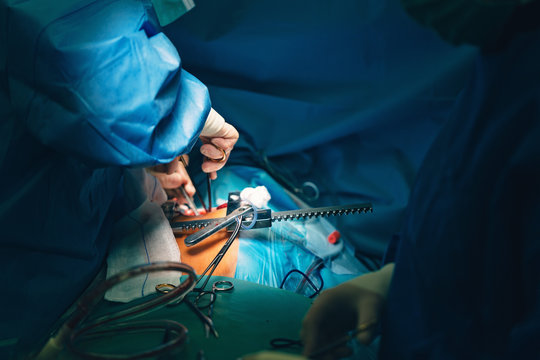 Team of surgeons in hospital operating room. Ready for cardiovascular surgery with cardiac retractors with mini thoracotomy retractor, clamps, forceps and all instruments for open heart microsurgery