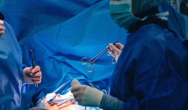 Team of surgeons in operating room. Passing a needle holder or a needle driver, a surgical instrument, or a hemostat, used by surgeons to hold a suturing needle for closing wounds during surgery