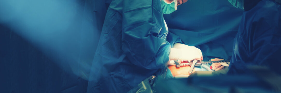 Medical team of surgeons in hospital doing minimal invasive surgical interventions. Surgery operating room with electrocautery equipment for cardiovascular emergency surgery center.