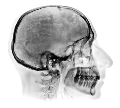 Detailed Human skull X-ray image