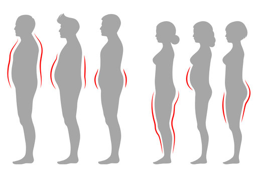 
Vector Illustration Of Obesity Woman And Man Body Type, Vector Figure Overweight Silhouette