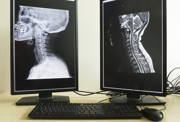 X-ray and MRI of neck in doctor office