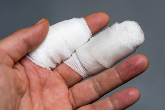 Hand mit zwei bandagierten Fingern, professionelle Wundversorgung nach Verletzung