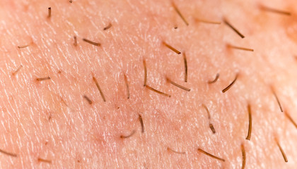 Bristles on the beard of a man