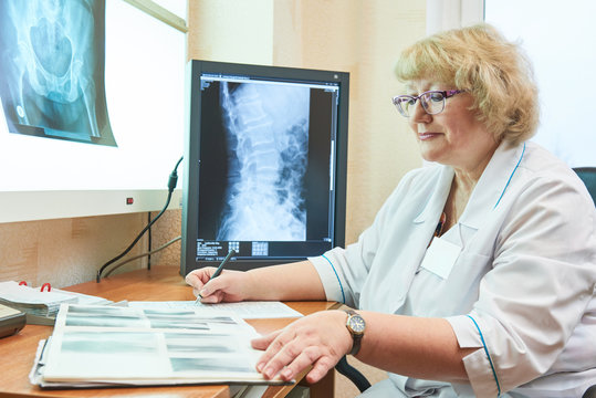radiology and healthcare. Fracture examination or illnes diagnosis