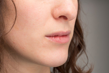 Cracked lips of female mouth