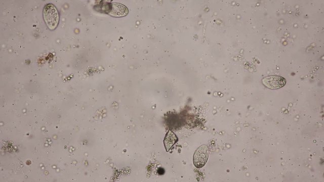 Bacterium and protozoa in waste water under the microscope.