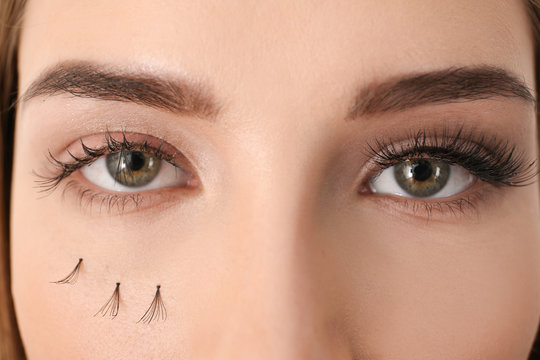Young woman with eyelash loss problem, closeup