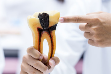 Tooth model for education in laboratory.