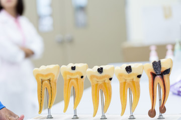 Tooth model for education in laboratory.