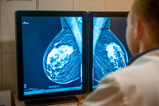 Doctor examines mammogram snapshot of breast of female patient on the monitors. Selective focus.