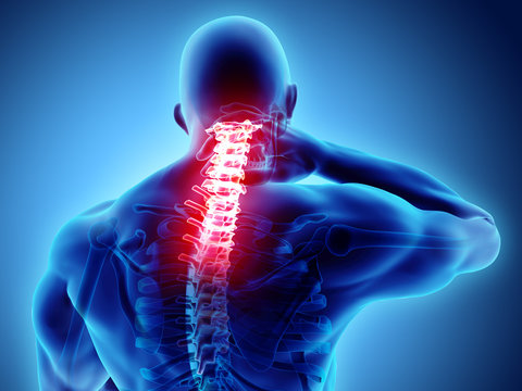 3D illustration, neck painful - cervical spine skeleton x-ray, medical concept.