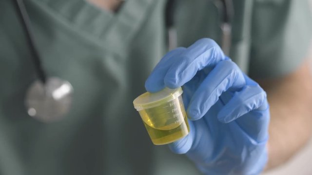 Doctor in uniform holding an urine sample and examining it.