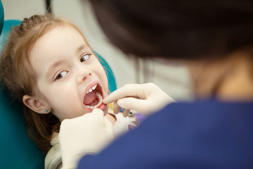 Dentist in rubber gloves checks mouth of child