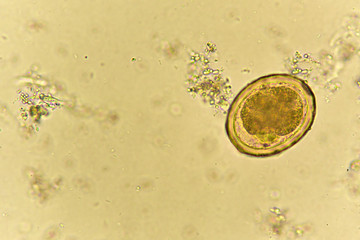 Egg of Ascaris lumbricoides (roundworm) in stool, analyze by microscope
